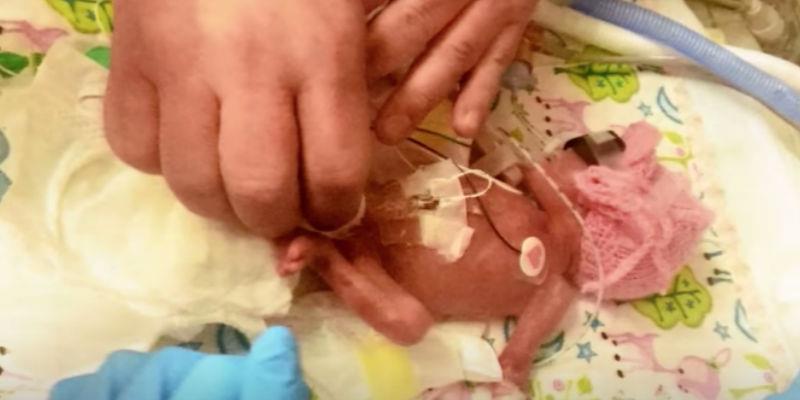 Baby wurde 2 Tage nach dem Abtreibungslimit geboren – 9 Monate später trotzte sie ihrem Todesurteil