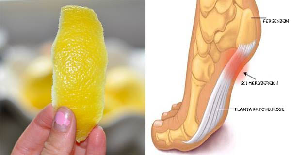 Eine Zitronenschale kann Gelenkschmerzen für immer verschwinden lassen