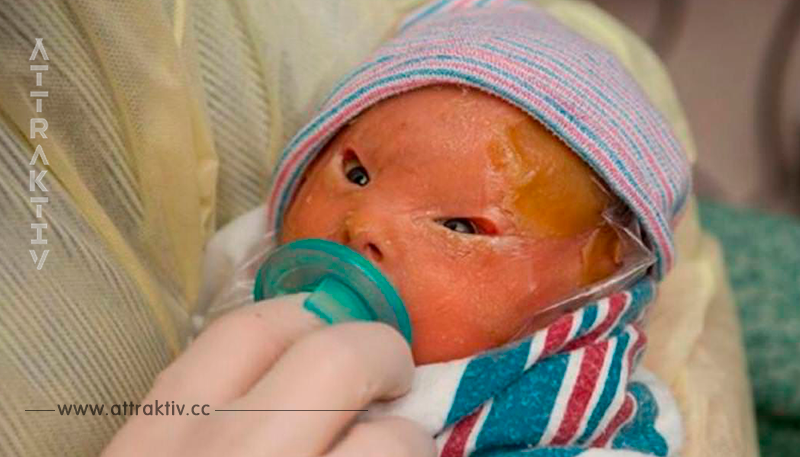 Das Aussehen ihrer Neugeborenen ist zunächst ein Schock – nun feiern Eltern auf der ganzen Welt die Worte dieser Mutter