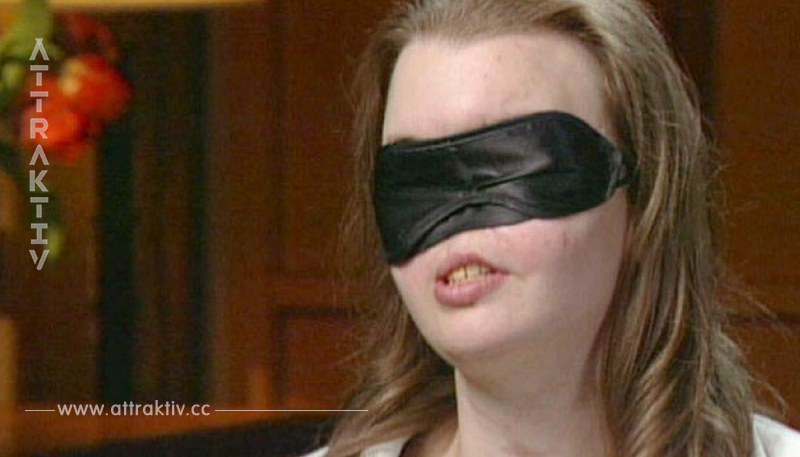 Chrissy verliert halbes Gesicht bei schrecklichem Unfall: 10 Jahre später entfernt sie Maske	