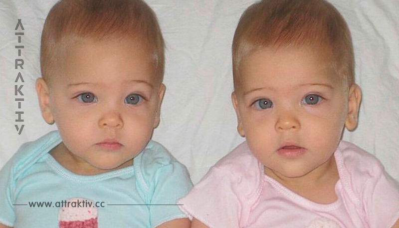 Eineiige Zwillinge wurden 2010 geboren: Jetzt sind sie fast 8 Jahre alt und werden als 