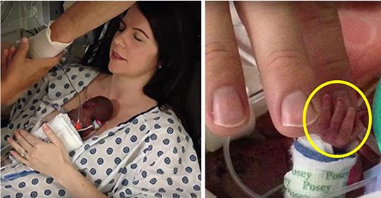 Mutter kann, zwei Wochen nach der Geburt, nun endlich ihr 340g schweres Baby im Arm halten