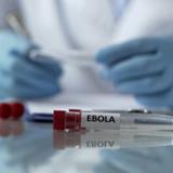 Ebola – eine tödliche Virus Infektion