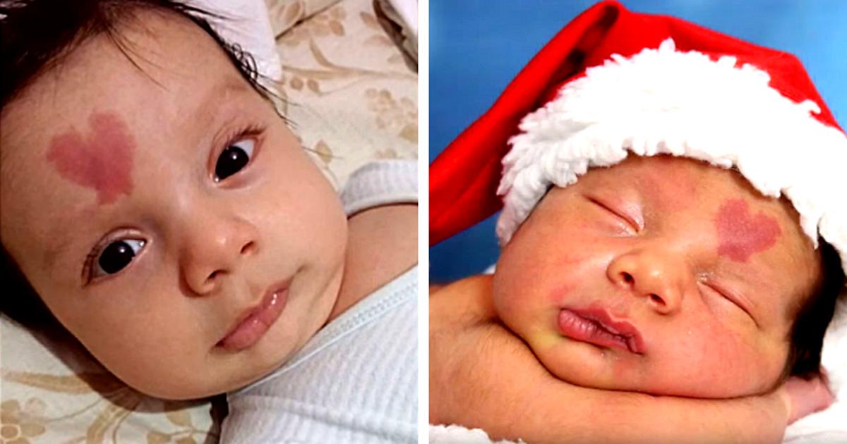 Triff das Love Baby: Einen reizenden kleinen Junge, der mit einem herzförmigen Muttermal auf der Stirn geboren wurde