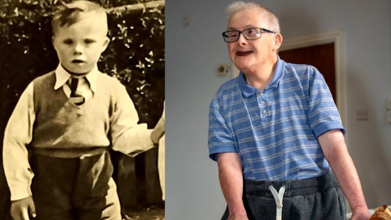 Rentner mit Down-Syndrom feiert seinen 77. Geburtstag – Einer der ältesten Betroffenen der Welt