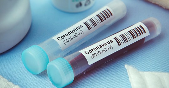 Coronavirus: Freiwillige infizieren sich für Mega-Summe mit Virus