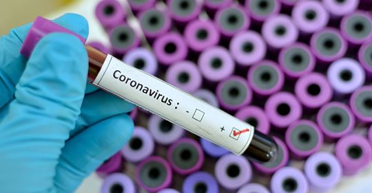 Coronavirus: Virologe Prof. Ulf Dittmer erklärt Umgang mit SARS CoV 2