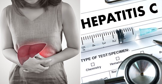 Leberentzündung: So kann Hepatitis behandelt und vorgebeugt werden