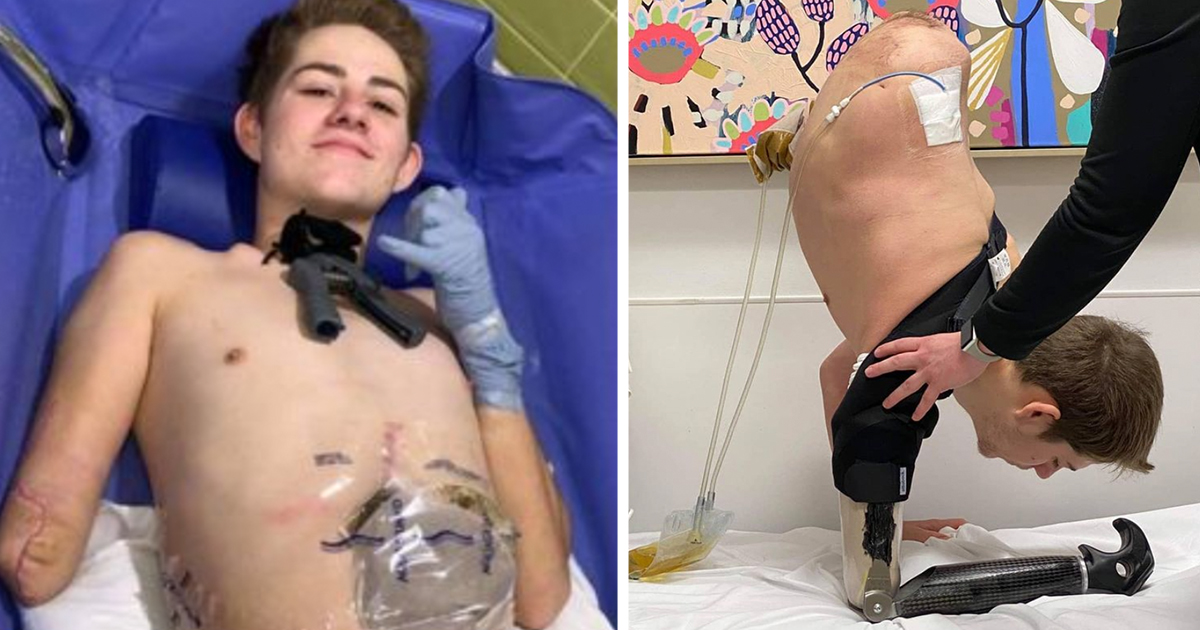 19 Jähriger wird von Gabelstapler zerquetscht, lässt sich unteren Körper amputieren – um sein Leben zu retten