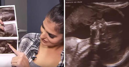 Schwangere Frau sieht, wie ihr verstorbener Vater ihre ungeborene Tochter auf dem Ultraschallbild küsst