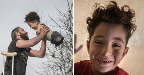 Der 5 jährige Mustafa al Nazzar bekommt endlich Prothesen